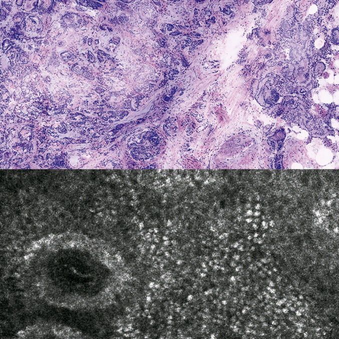 Vivascope Medicinelaser Latam