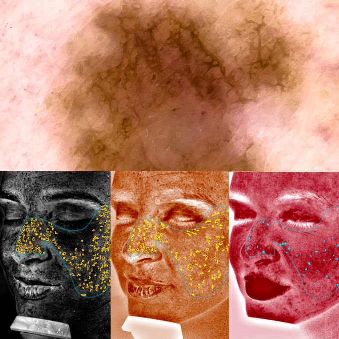 Canfield Medicinelaser Latam