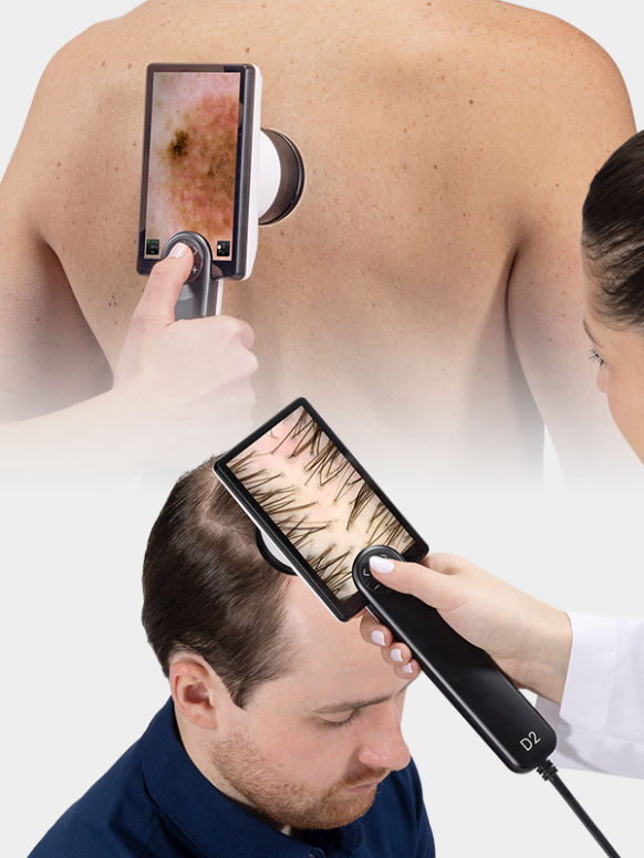 D2 Canfield Dermatoscopio Digital