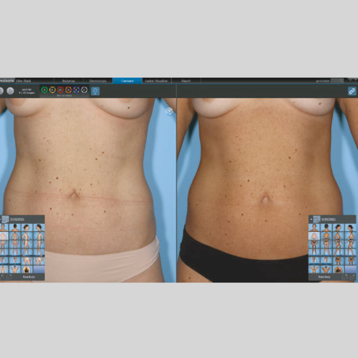 Intellistudio Canfield